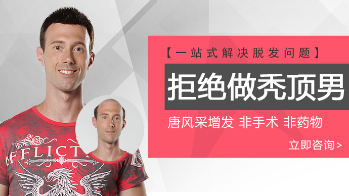 禿頂改造 拒絕做禿頂男