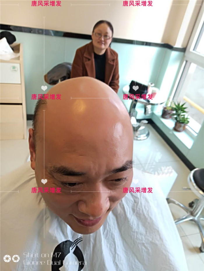 禿頂改造 唐風(fēng)采客戶
