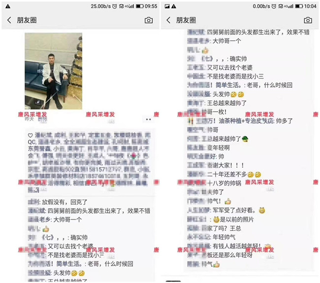 補發(fā)織發(fā)效果如何 王先生的朋友圈