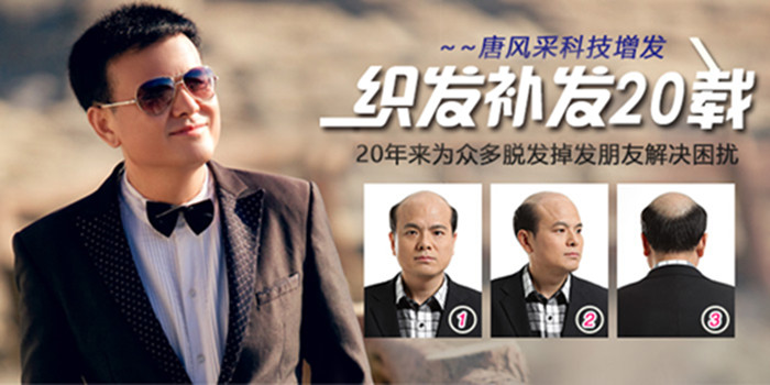 補發(fā)織發(fā)效果如何 唐風(fēng)采織發(fā)補發(fā)