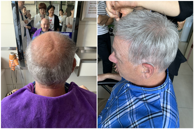 無痕補發(fā)哪家好 外國人也到唐風采補發(fā)