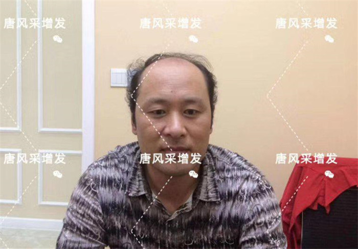 怎么快速增發(fā) 唐風(fēng)采客戶(hù)增發(fā)前