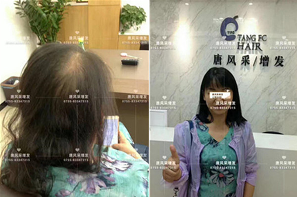 買假發(fā)哪個牌子好又便宜 唐風采客戶案例