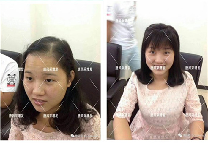 無痕補發(fā)看得出是假發(fā)嗎 唐風采客戶增發(fā)后