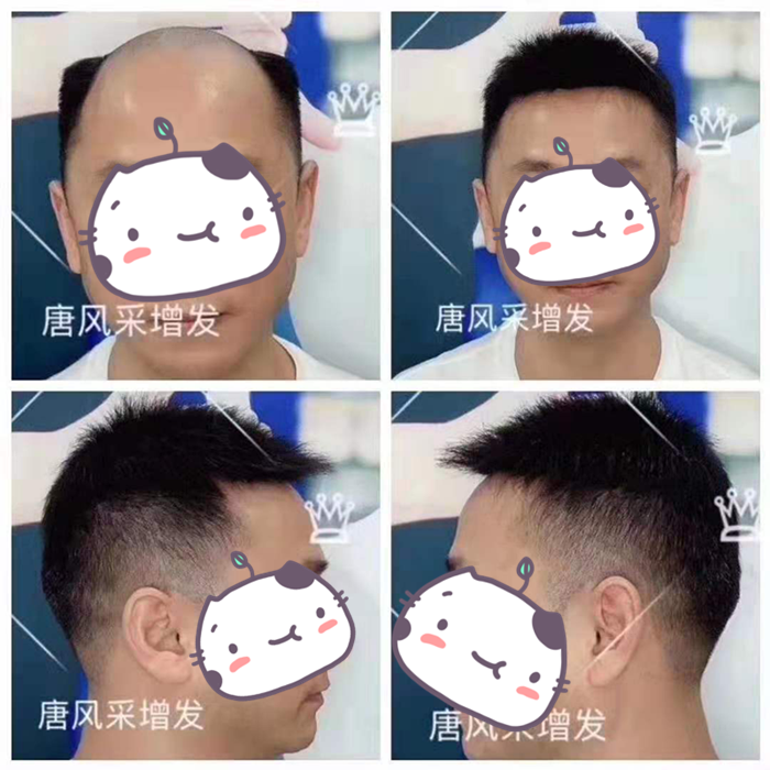 網(wǎng)上哪里買假發(fā)好 實(shí)體店可以觀察很多做工細(xì)節(jié)