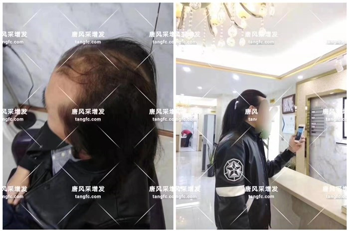 50歲一60歲的男士假發(fā) 像自己的頭發(fā)一樣