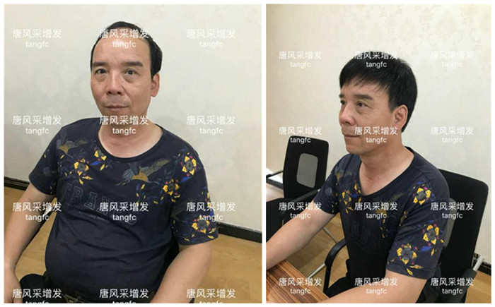 中老年假發(fā)套的款式圖片 一頂假發(fā)就能改變形象