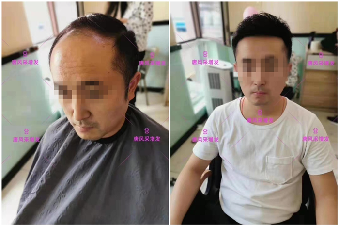 老年假發(fā)套 想找回帥氣自信就來(lái)唐風(fēng)采