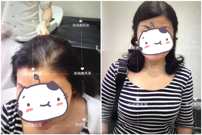 中老年女士假發(fā) 唐風(fēng)采客戶案例圖