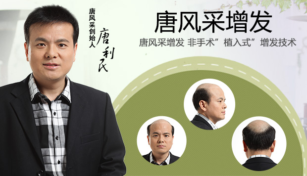 哪能買到兒童假發(fā)頭套 小朋友嚴(yán)重脫發(fā)怎么辦