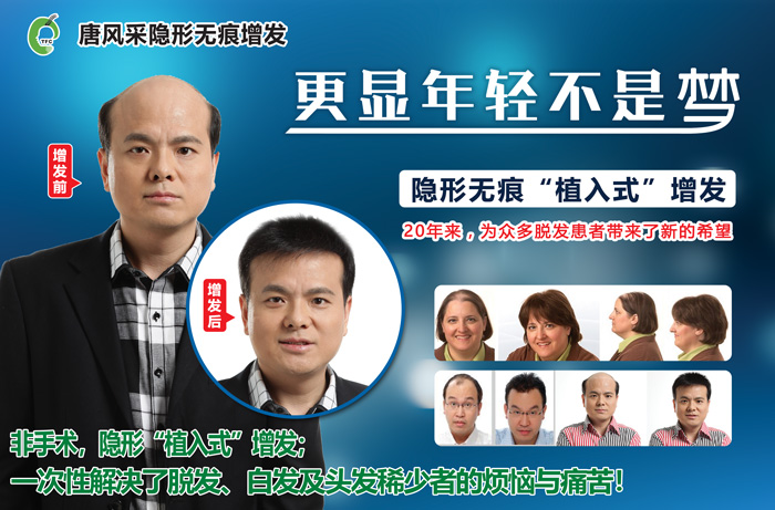 哪能買到兒童假發(fā)頭套 小朋友也可以戴假發(fā)