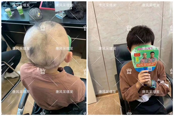 假發(fā)頭套 可以選擇到唐風(fēng)采購買假發(fā)