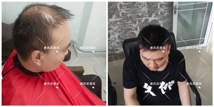 男老年假發(fā)套 唐風采客戶案例