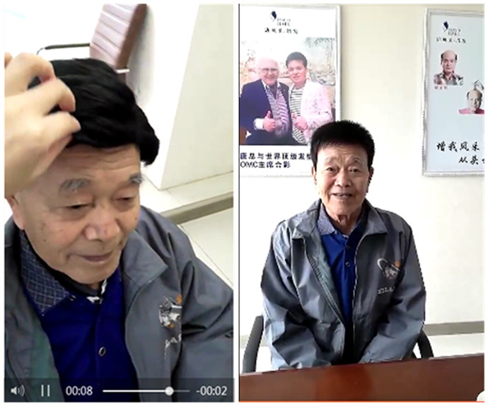 真發(fā)假發(fā)套的價(jià)格 唐風(fēng)采客戶戴假發(fā)前后對(duì)比