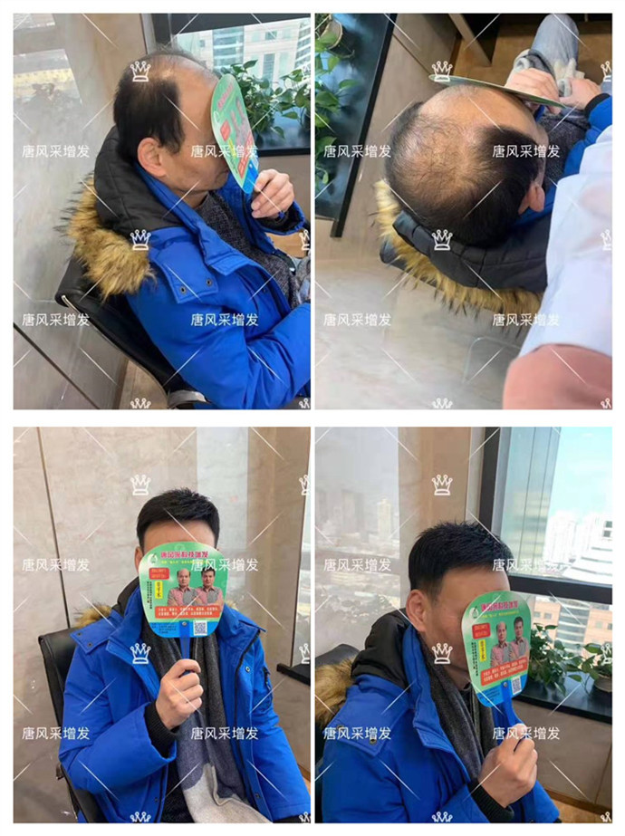 可以洗的假發(fā) 唐風(fēng)采客戶(hù)案例