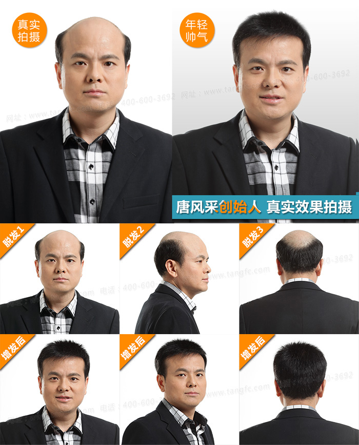 一個(gè)假發(fā)大概多少錢 高檔真人發(fā)假發(fā)