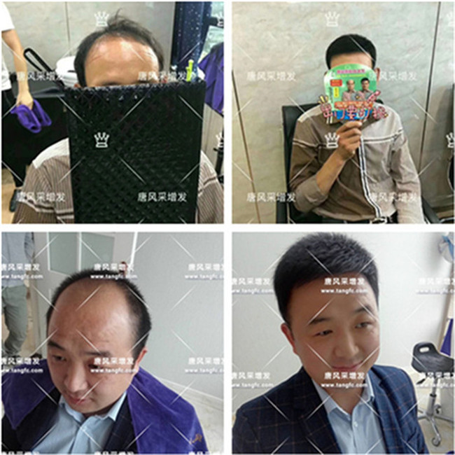 一個(gè)假發(fā)能用多久, 專業(yè)假發(fā)專賣店會(huì)提供護(hù)養(yǎng)服務(wù)