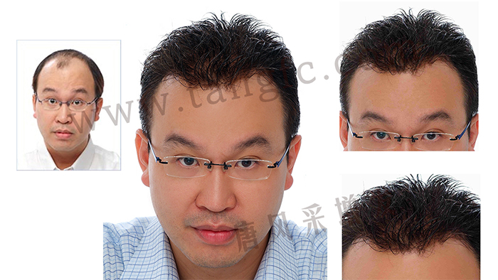 如果你hold不住謝頂，可以來試試真人頭發(fā)的假發(fā)