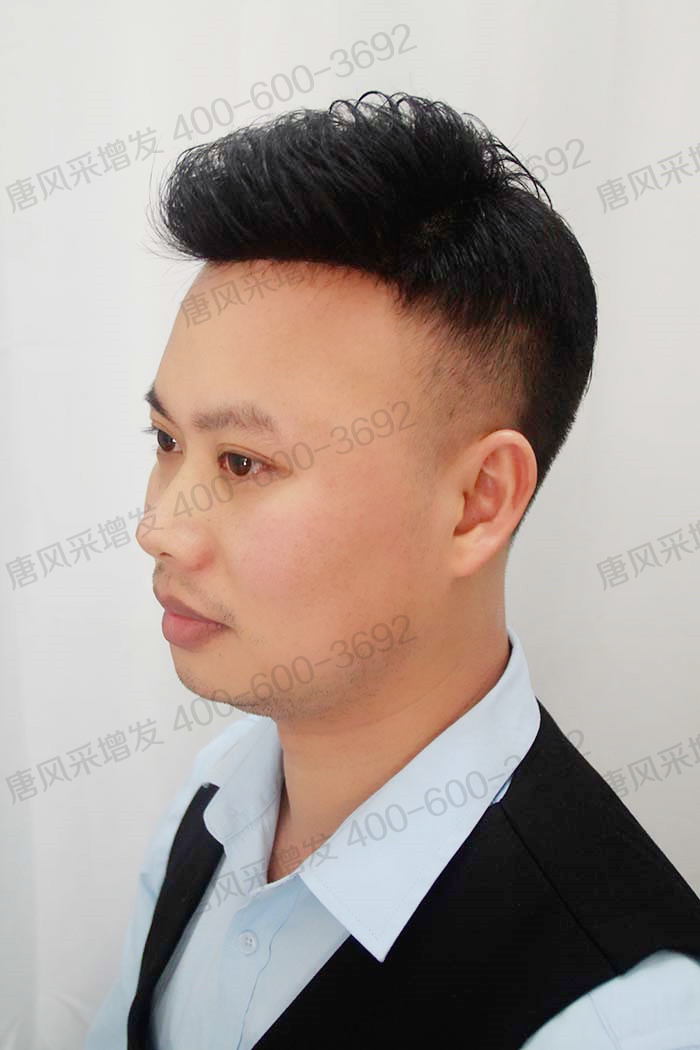 貼在頭頂?shù)募侔l(fā) \