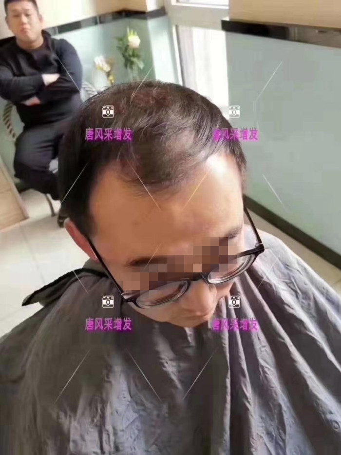 透氣假發(fā)品牌 \