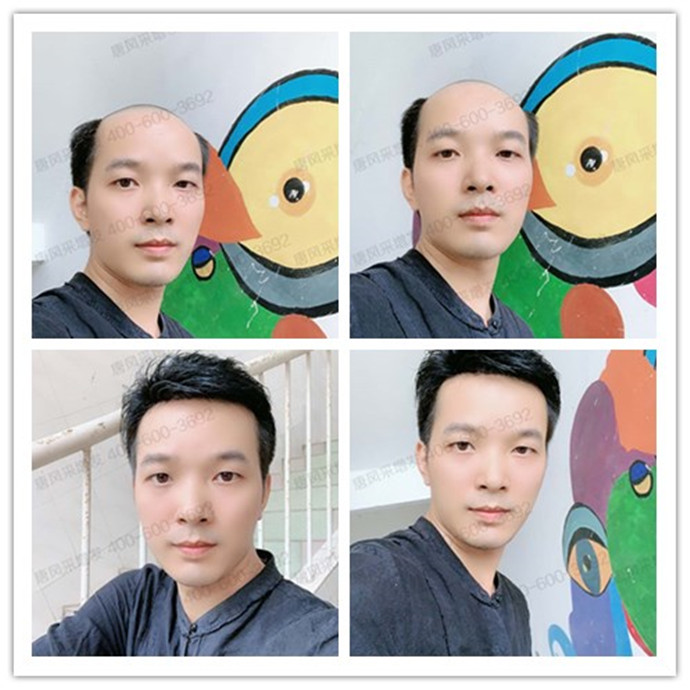 透氣假發(fā)品牌 \