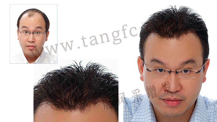 男士假發(fā)塊粘貼佩戴 \