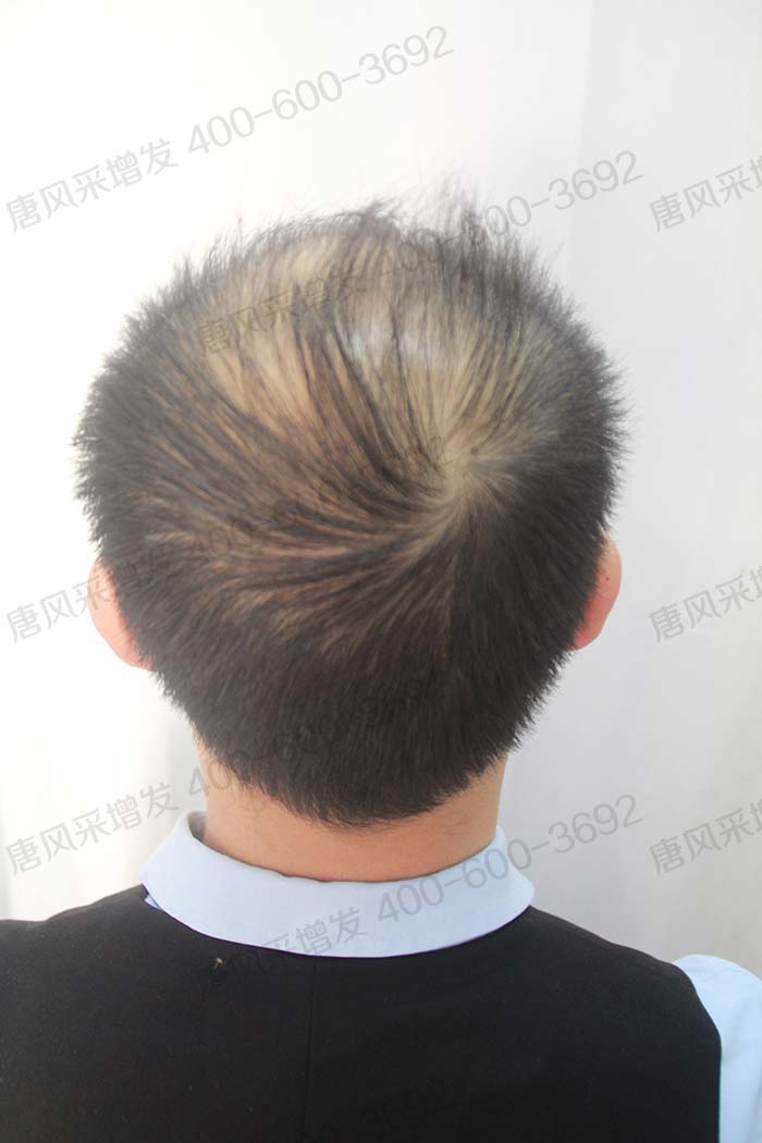 男士假發(fā)塊 \
