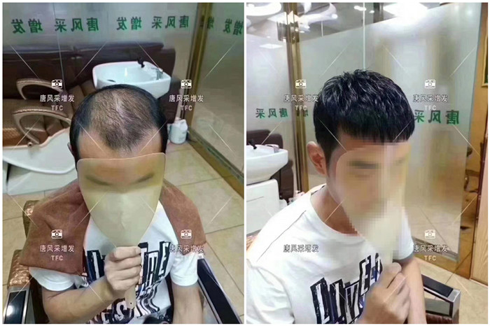 男士假發(fā)怎么打理 \