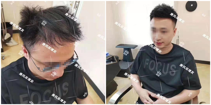 假發(fā)怎么打理自然 \