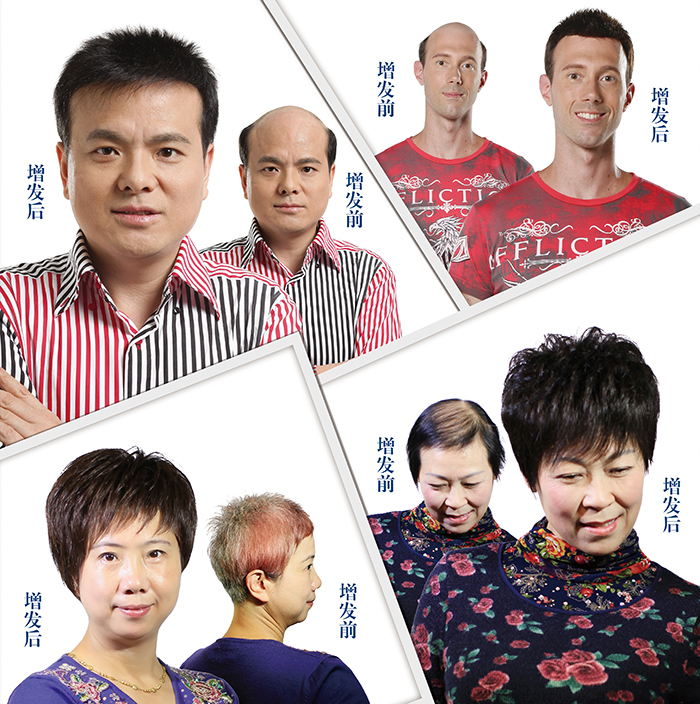 假發(fā)選哪個(gè)品牌好 \