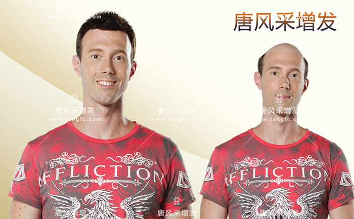 如何購(gòu)買(mǎi)假發(fā) \