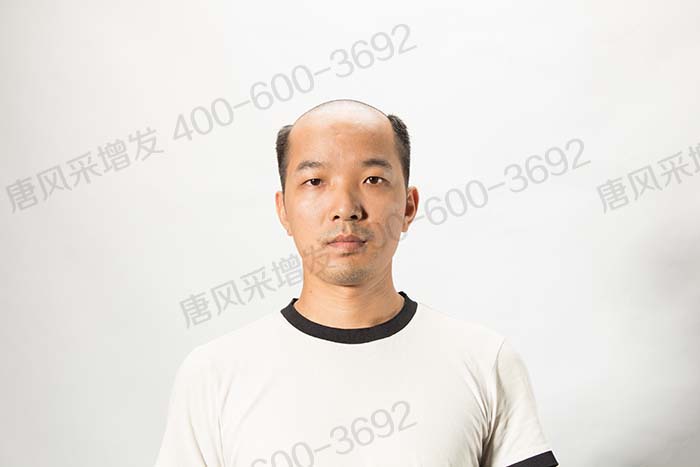 購(gòu)買(mǎi)假發(fā) \