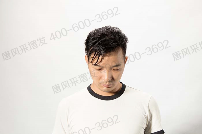 如何購(gòu)買(mǎi)假發(fā) \