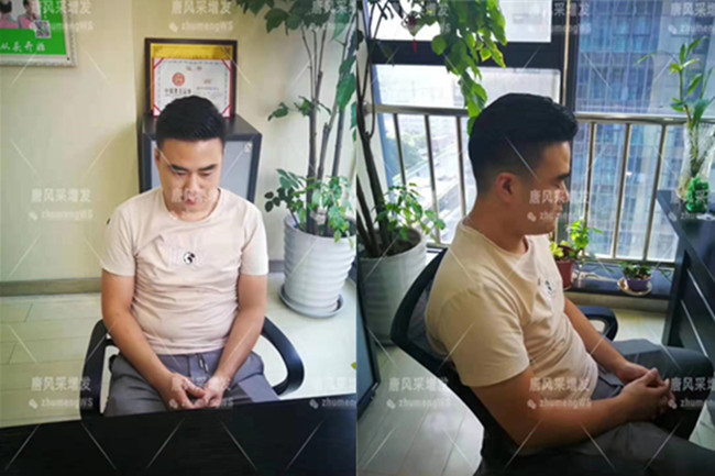 如何購(gòu)買(mǎi)假發(fā) \