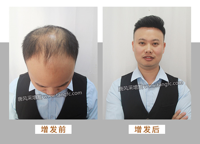 男士假發(fā)背頭 \