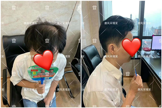 男士假發(fā)背頭 \