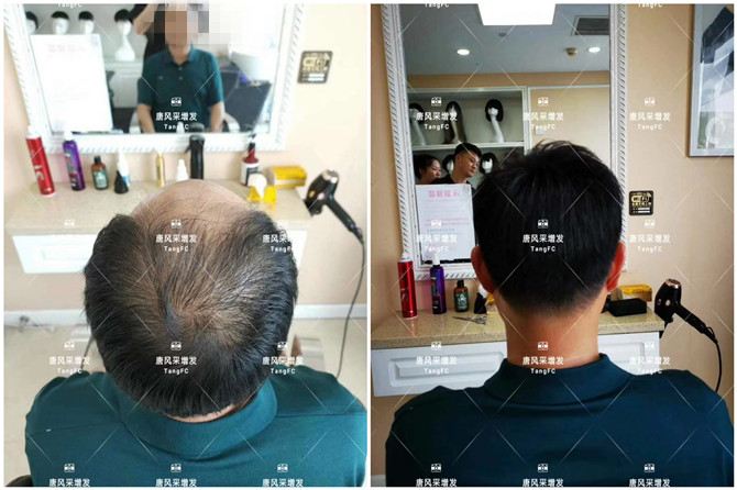 男士假發(fā)片 \