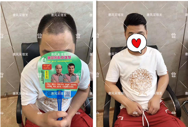 買男士假發(fā) \