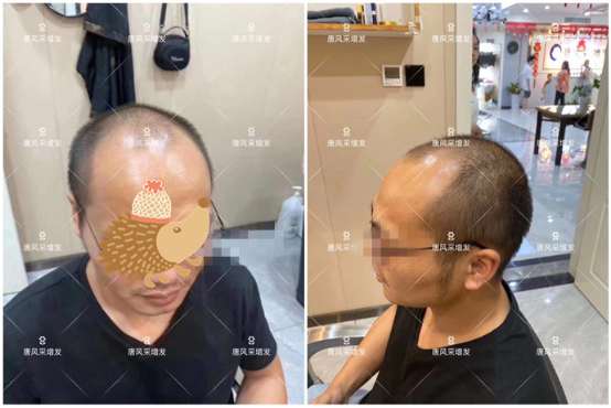 中老年真假發(fā)專(zhuān)賣(mài)店 \