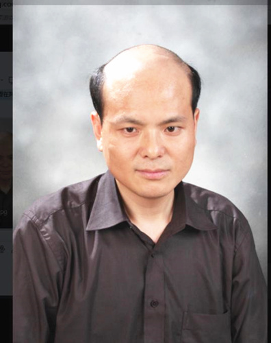 頭發(fā)少戴禿頂假發(fā)片好嗎 \