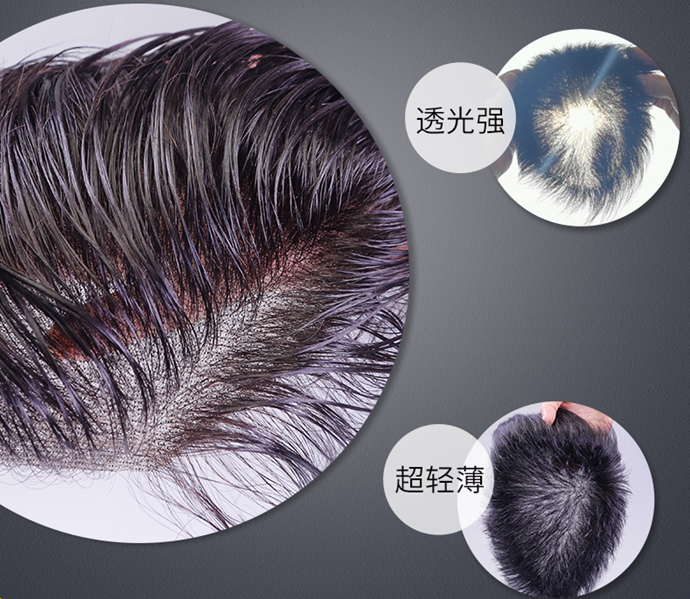 頭發(fā)少戴禿頂假發(fā)片好嗎 \