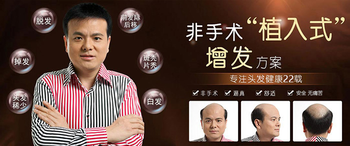 頭發(fā)少戴禿頂假發(fā)片好嗎 \