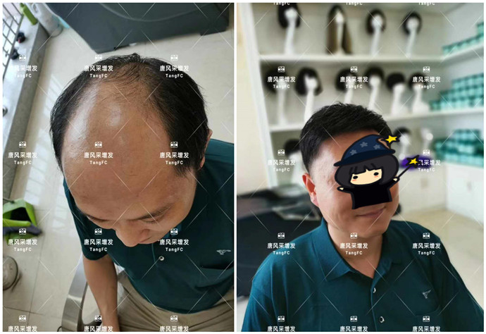 抖音網(wǎng)紅假發(fā) \