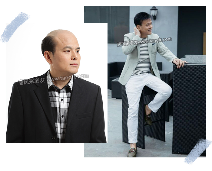 男士買假發(fā) \