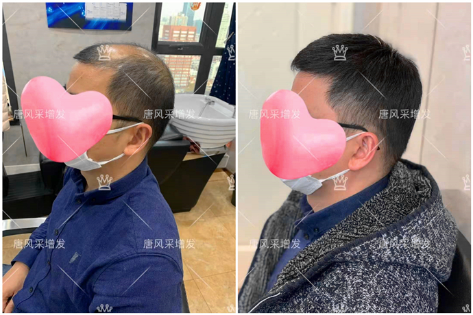 男士買假發(fā) \