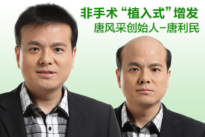 買男士假發(fā) \