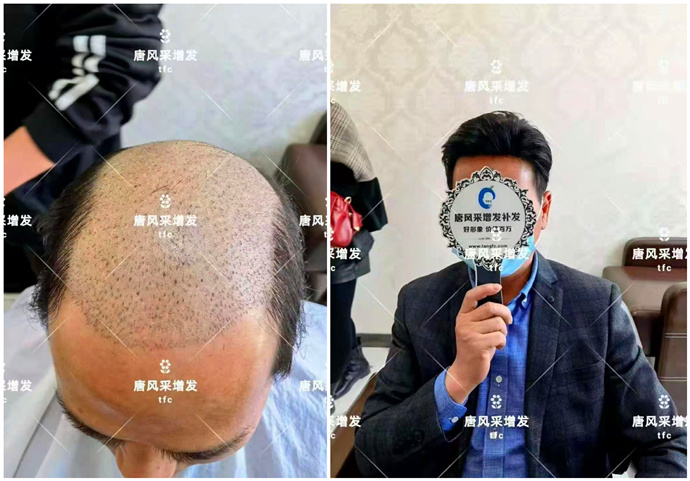 買男士假發(fā) \