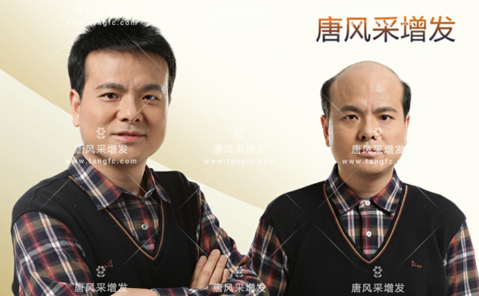 專業(yè)男士假發(fā) \