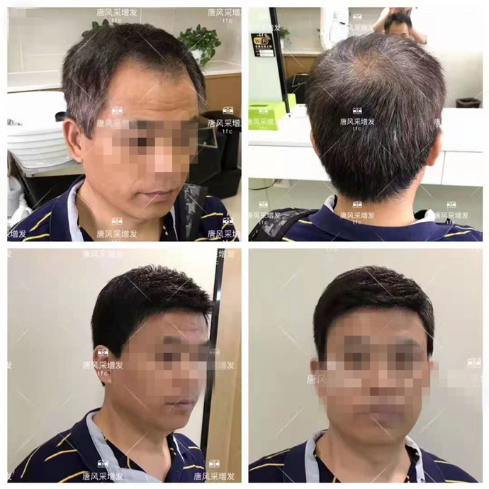 補(bǔ)發(fā)片哪個(gè)牌子好 \