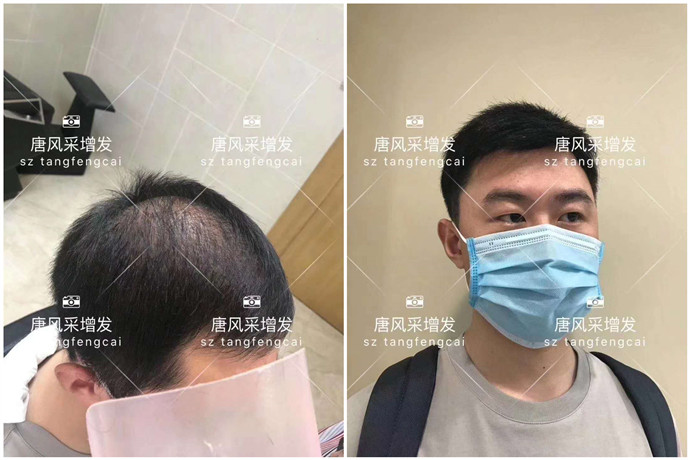 補(bǔ)發(fā)片哪個(gè)牌子好 \